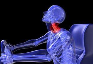get compensated for whiplash injury in SG